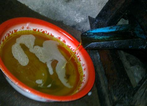 健康管理，关注血脂指标，守护心血管健康